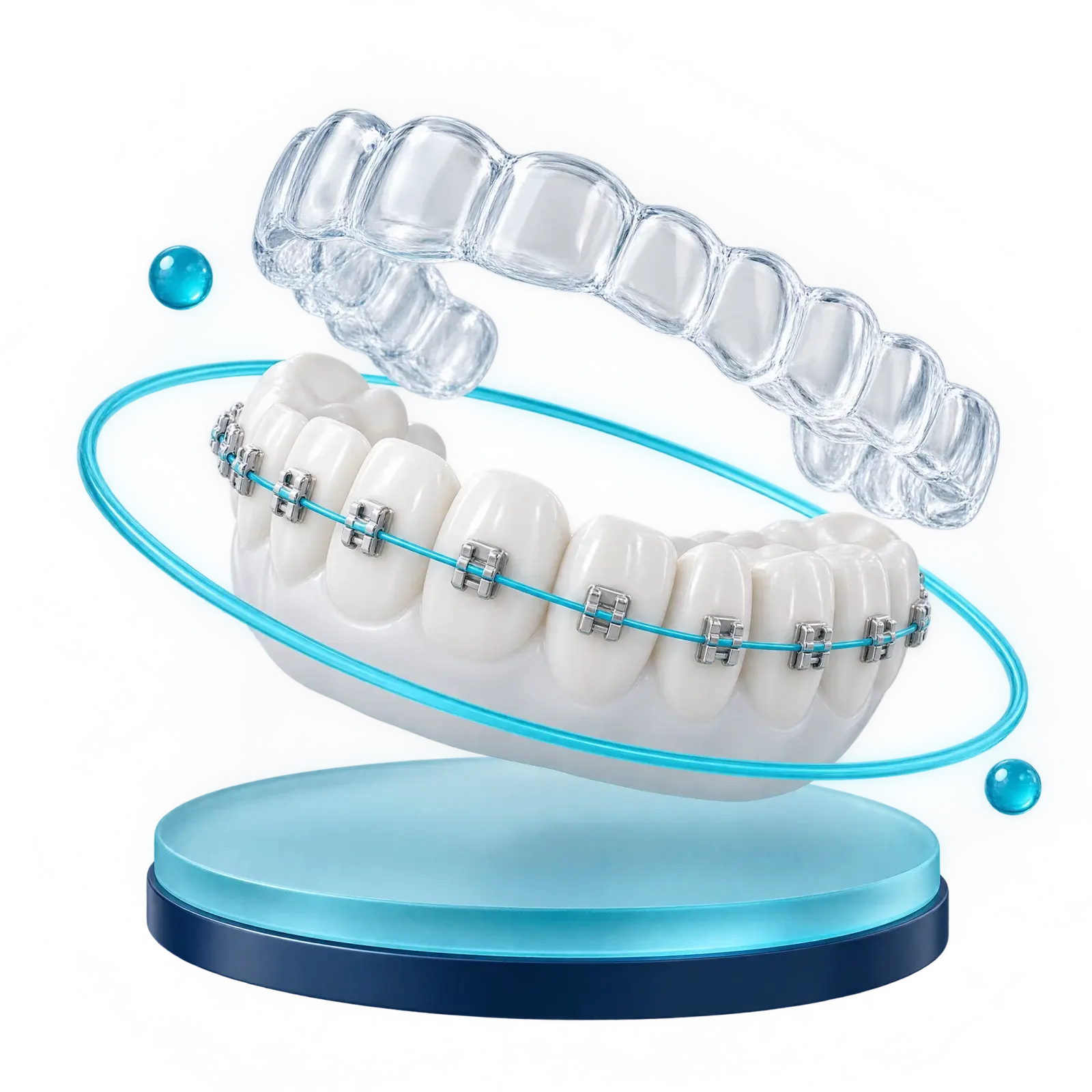 Clear aligner above teeth with braces