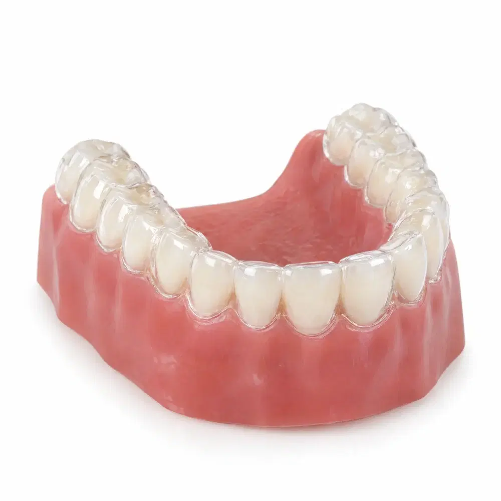 3D model of a clear aligner tray